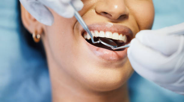 Best Same-Day Emergency Dental Services in County Center, VA