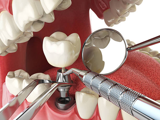 Best Same-Day Emergency Dental Services in County Center, VA